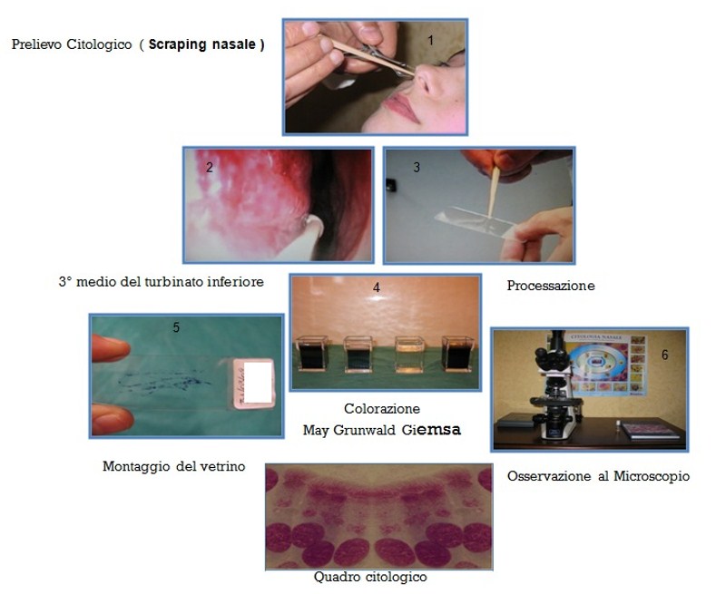 prelievo citologico