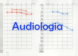 audiologia